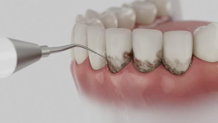 Reliable Dental contractor in Tiffin, OH by Dentist Open Now